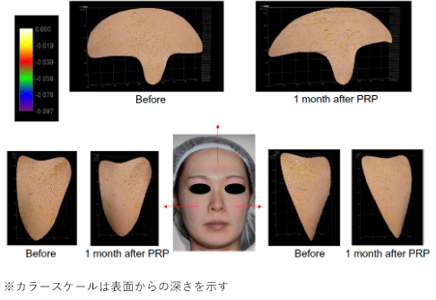 3D写真による検証