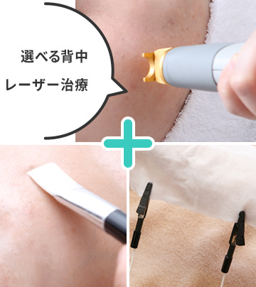 背中パーフェクトコース