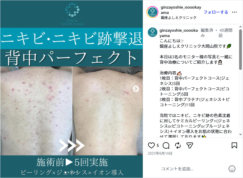 銀座よしえクリニックインスタグラム