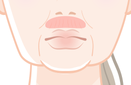 <鼻の下のしわ/鼻の下が長い>