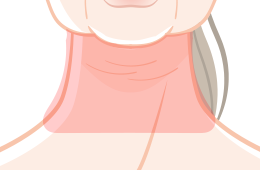 <首のたるみ/首のシワ>