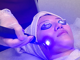 ブルージェネシス(鼻・頬) +イオン導入(顔全体)