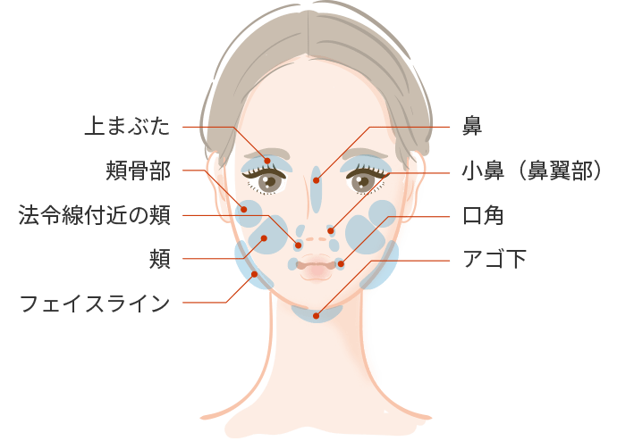 BNLS注射の適用部位（顔）