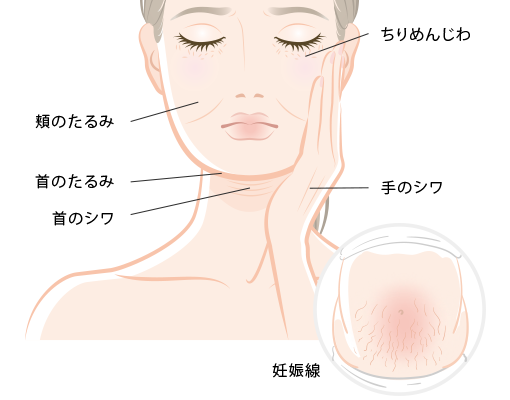 ハリの向上、シワたるみの改善