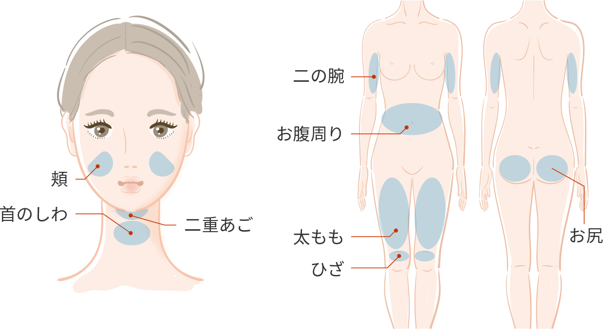 たるみが気になる部位