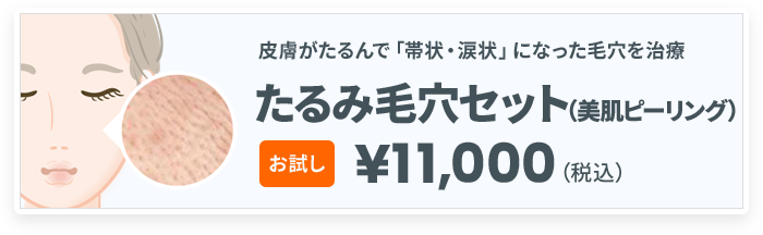 たるみ毛穴セット（美肌ピーリング）お試し¥11,000