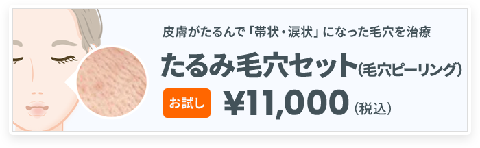 たるみ毛穴セット(毛穴ピーリング)お試し¥11,000