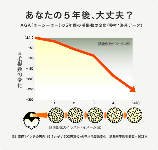 AGAの5年間の毛髪量の変化