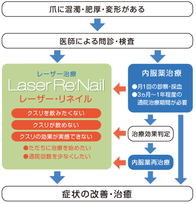 しつこい爪水虫に効果的なレーザー治療