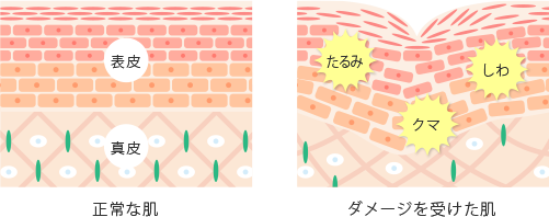 肌の構造