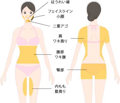 ネオベラの施術部位