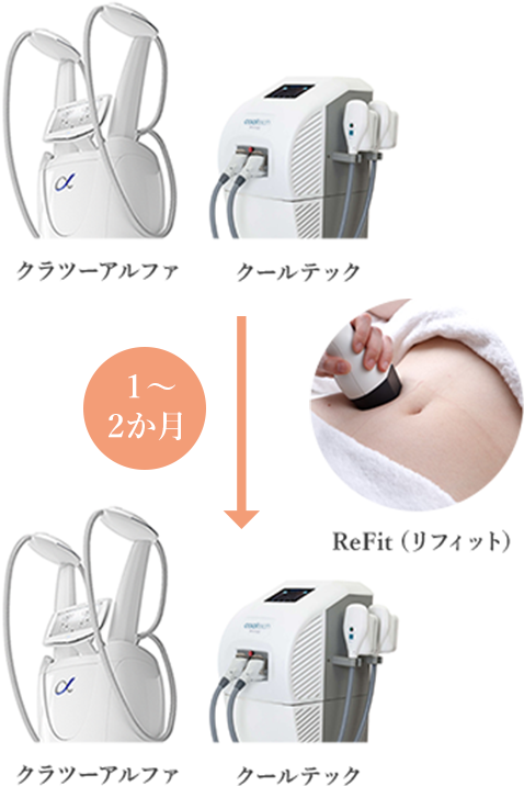 「脂肪冷却痩身」で脂肪を取ってから皮を引き締める