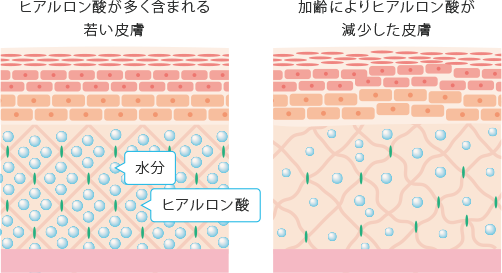 ヒアルロン酸とは