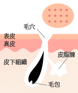 毛穴の開き