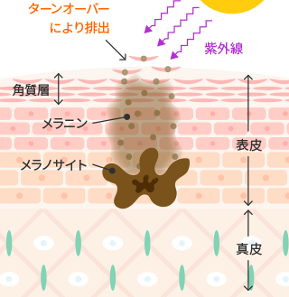 しみができるメカニズム