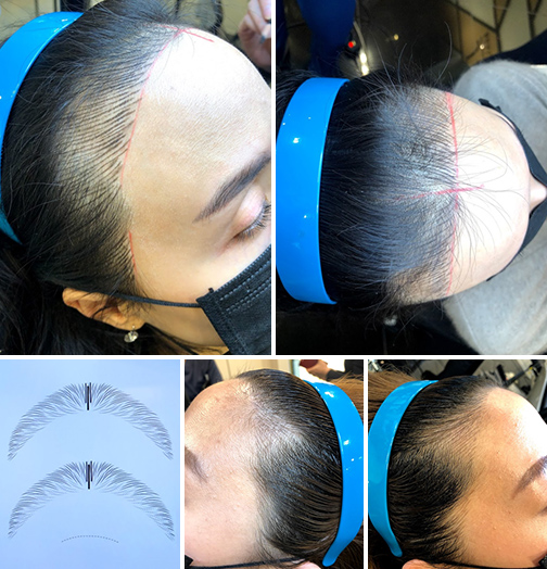 アートメイク(ヘアライン・生え際)の特徴