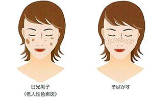 しみの特徴例