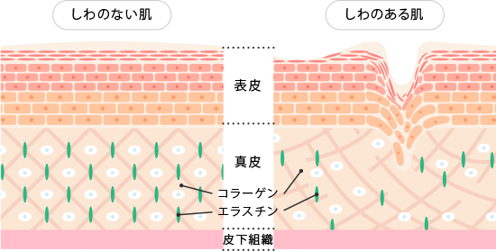 眉間のシワ、おでこのシワ、目尻のシワの原因