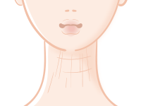 首の縦ジワができる原因