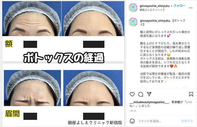 銀座よしえクリニックインスタグラム