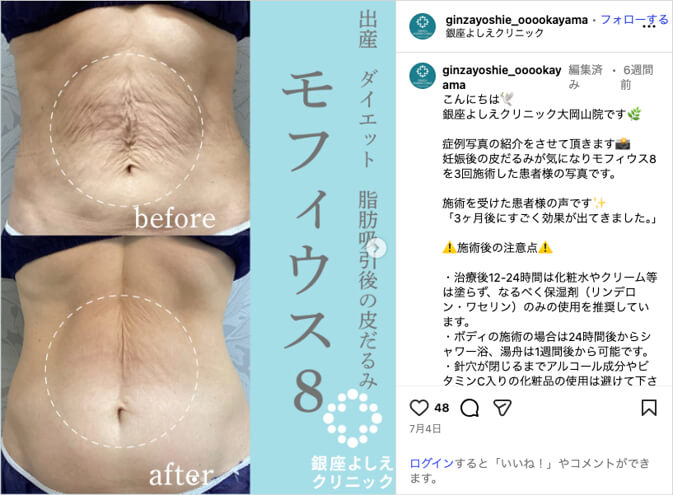 銀座よしえクリニックインスタグラム
