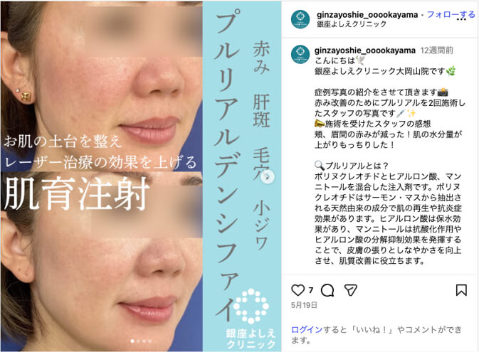 銀座よしえクリニックインスタグラム