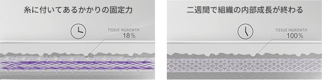 リフトアップ力の持続期間