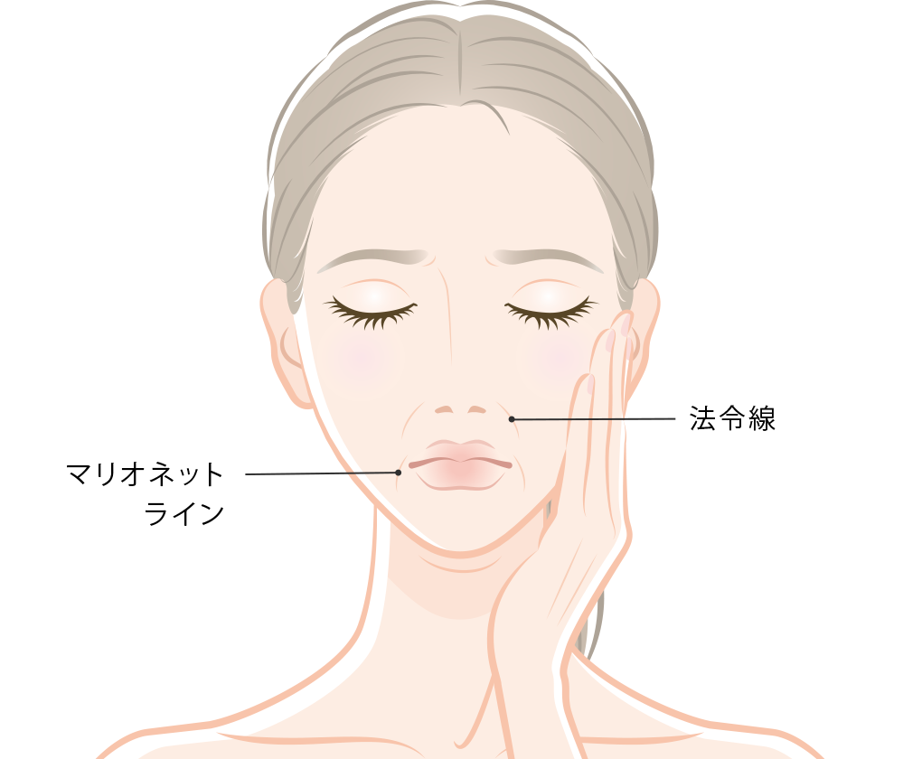 テスリフトソフトの適応部位